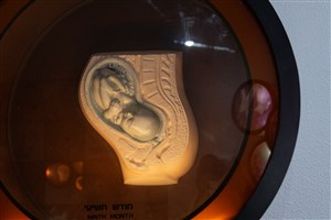 Image description is not available for 1983.71.1